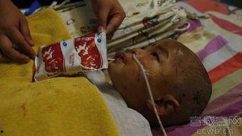 吃瓜被咬掉一块肉视频,网友直呼太真实  第2张